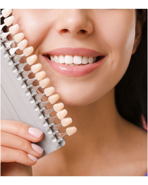 How Does Porcelain Dental Veneer Work? 2