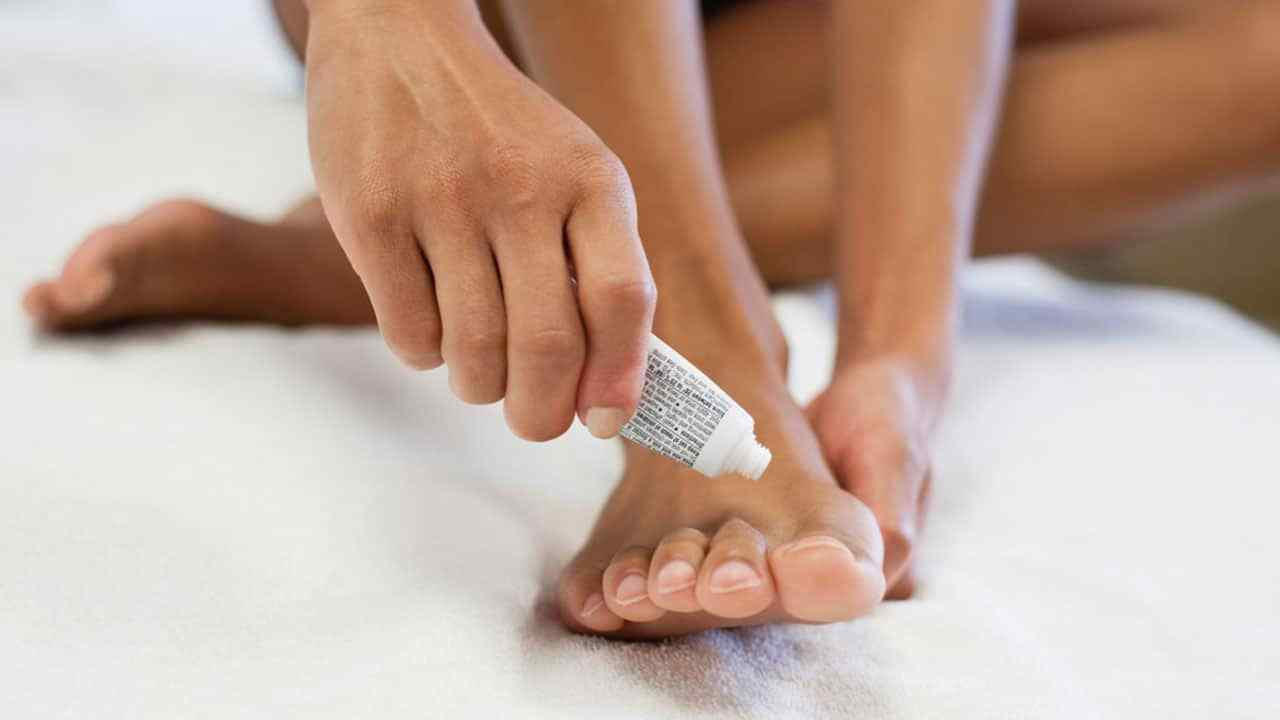 Use the best anti-fungal foot cream and obtain the best results 1