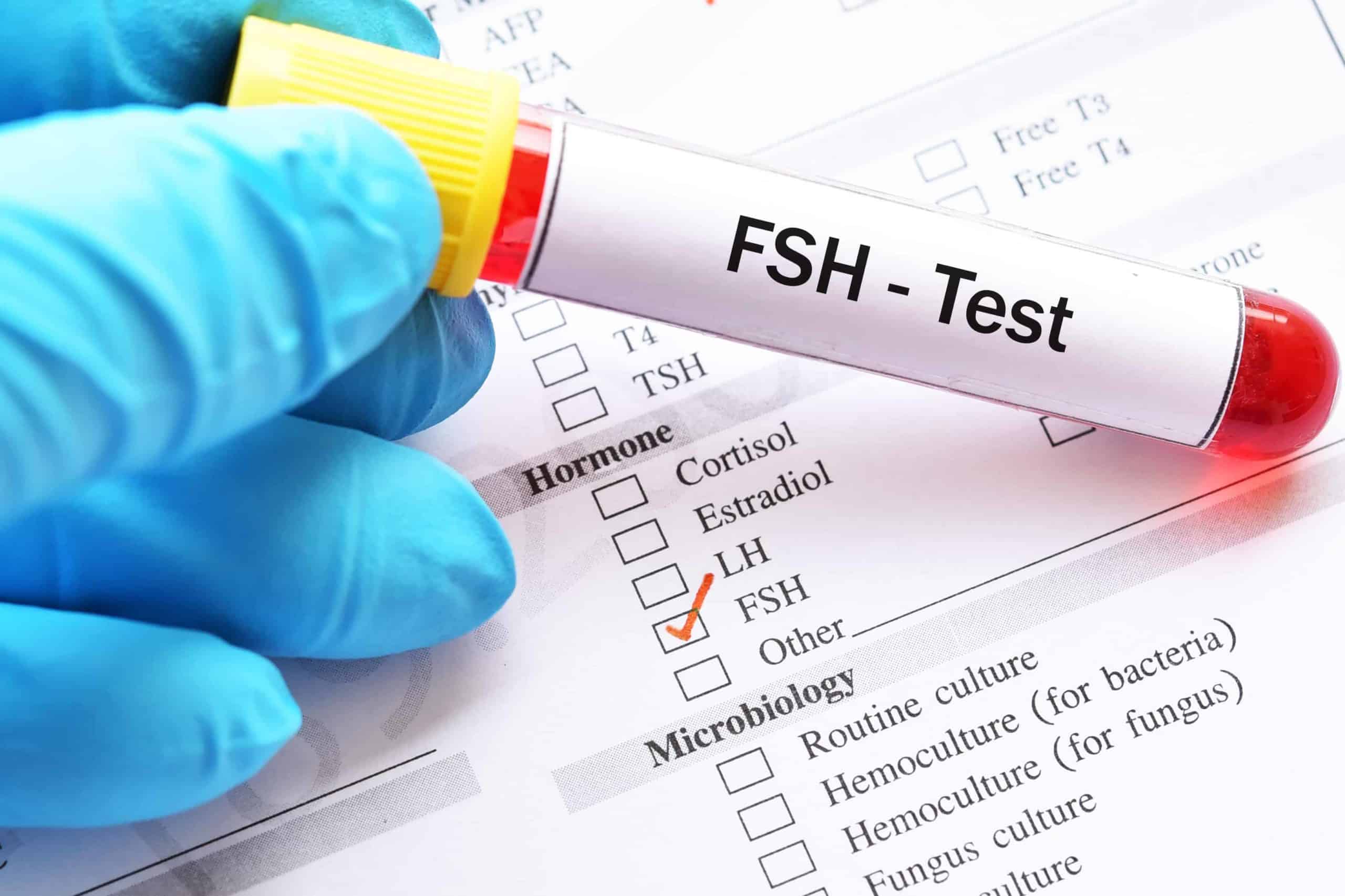 What is the use of FSH in the Human Body and why it is needed?