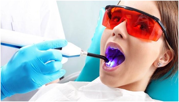 Wisdom Tooth Extraction Using a New Technology Called Laser 1